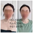 수성동 제일아파트 | 대구신부관리 수성구윤곽관리 온열뱀부테라피 미소스킨앤바디