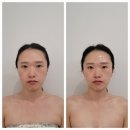 미키PC방(동산점) | 대구 달서구 다사피부관리 앤이샘에스테틱에서 새얼굴테라피로 존예완성🌿