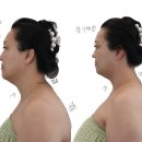 퓨어셀에스테틱