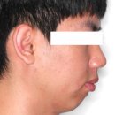 자연미소치과 | 안양교정치과 서울고운미소치과 교정 후기