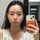 [제이엘유]물방울초음파 디바이스 하이소닉M으로 홈케어관리효과 3주 실사용후기(+사진있음)