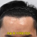모엠의원 네이버블로그
