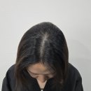 블랙샌드뷰티 | 정수리 휑하고 가르마 벌어진 분들께 추천! [분당야탑두피문신] 리얼 후기 (블랙샌드뷰티)