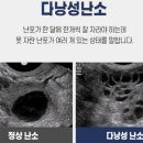 수지의원 이미지