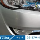 덴트존 이미지