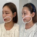 눈가 잔주름 세럼 찾는다면? 스테이유스 30대 아이세럼 솔직 사용 후기