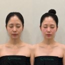 에스테틱도도 | 평택피부관리 윤곽 탄력 한 번에! 고덕 도도에스테틱 알테온 관리후기