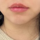 립라인스튜디오 | 오버립타투로 말린입술 립라인 교정 후기 / 오버립반영구