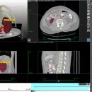 빅메디컬 이미지