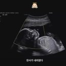 훈 이미지