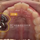 동암플란트치과의원 이미지