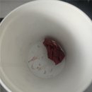 대전 더봄구강악안면외과치과 매복 사랑니 발치후기(feat. 치수염? 발치 후 통증 식사)