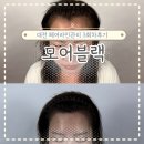 차와사람 | 대전 헤어라인 두피문신 모어블랙 2,3회차와 최종후기까지
