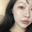 강남피부과 클라리티 &amp; 루카스 토닝 레이저 프리미엄 내돈내산 후기(홍조, 색소침착, 여드름흉터, 가격)