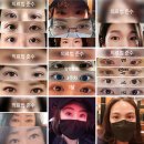 디자이너성형외과의원 | 쌍수 후기 디자이너성형외과 3월 정리