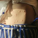 조아피부과의원 | 서울 영등포 피부과 추천 사려니의원 - 예민보스 얇은피부 여자사람의 선택 (편평사마귀,비립종,점...