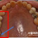 서울미라클치과의원 이미지