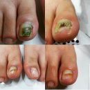 레푸스상무점