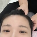 [청주 피부관리] 올가드림뷰티에서 모공디톡스와 모낭충검사 후기