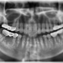 서울산성플란트치과의원 이미지