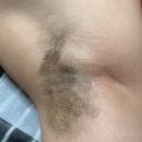 파리바게뜨면목 | 상봉왁싱 털공장 남자 겨드랑이 왁싱 처음 받아본 후기