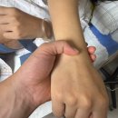 (주)태위 | [38주 5일] 초산모 유도분만 실패 응급제왕절개 후기😭그래도 무사 출산한 후기❤️ 마지막 임신 일기