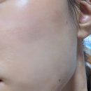 뷰티몬스터짐 | 강남역 얼굴 화이트태닝 5회차 후기 탠몬스터 강남역점 뷰티엔젤 ELT3