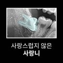 시흥장곡역치과의원 | 사랑니 때문에 걱정되시죠? 시흥장곡역치과