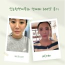 제이디바이오 | 신논현역피부과 모공, 탄력 개선에 좋은 덴서티300샷 일주일 찐 후기!