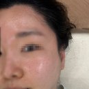 천방인테리어 | 김포 모공축소관리 천방케어로 빛나는 피부 루미힐에스테틱
