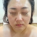 아산 배방 피부관리샵/지앤미피부관리; 웨딩케어...신부피부관리),윤곽관리 추천 ft.원쎄라리프팅솔직후기