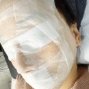 천안상패 | [스킨메디아] 스킨플래닝 후 깐달걀 된 천안피부관리 후기