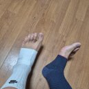럼보트 | [리뷰/사용기]아킬레스건 보호대 총정리 2025-2026 건염이 있을 때 스포츠활동할 때 데일리사용 많이...