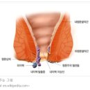 연세유쾌항외과 네이버블로그