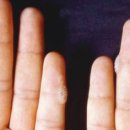 눈꽃피부과의원 이미지