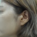 대은목욕탕 | 편평사마귀 고민해결해준 고마운 낙성대한의원