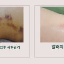 황금피부관리