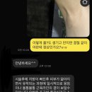 바보언니 | 팔뚝 지팻 지방추출주사 2주 경과｜통증, 바본,유착, 변화 솔직 후기