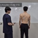 운동처방학및실습 조별과제 5조 (Winging scapular) 이미지