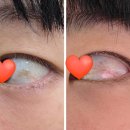 탑플러스안과의원 이미지