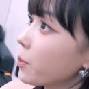 ♥송도 코 재수술 성공 후기♥ 송도 리더스 성형외과