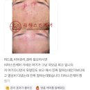 리하스킨케어