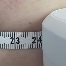 리바디핏 | 청라에스테틱 리바디라인에서 팔뚝관리 받은 후기