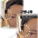 장미 수선 이미지