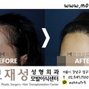 모재성성형외과의원 이미지