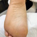 레푸스 연산점 네이버블로그