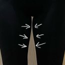 대해한의원 | 수원 허벅지 지방분해주사 후기ㅣ인계동 고든한의원