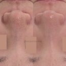 유림메디컬 | [처인구·역북동 피부관리] 모공 관리해도 다시 넓어지는 이유숨은 피부관리실 없을까요?