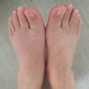 전대365약국 | 광주 전대 365 약국, 발등 부은 할머니께 류마스탑 쿨 후기