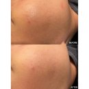 에이치메디컬케어